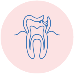 root canal treatment in gurgaon
